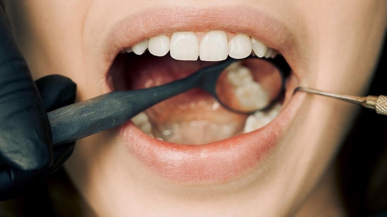 El truco casero para eliminar el sarro de tus dientes en tiempo récord